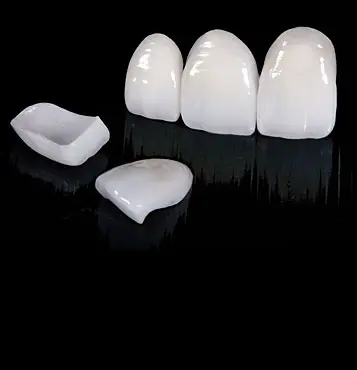porcelain veneers norwich