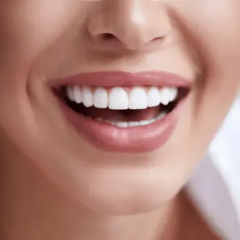 improve your smile